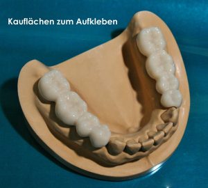 Kauflächen zum Aufkleben 1