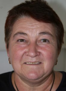 vorher vorher